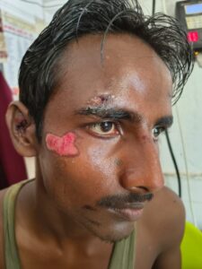 वाल्मीकि व्याघ्र आरक्ष में ड्यूटी से लौटते समय गैंडा ट्रेकर पर हुआ जानलेवा हमला