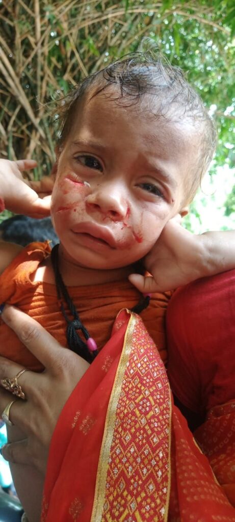 सनकी बंदर ने लोगों का किया जीना मुश्किल ।